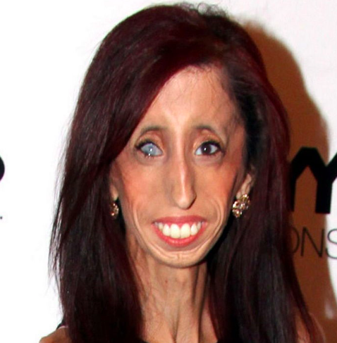 Lizzie Velasquez